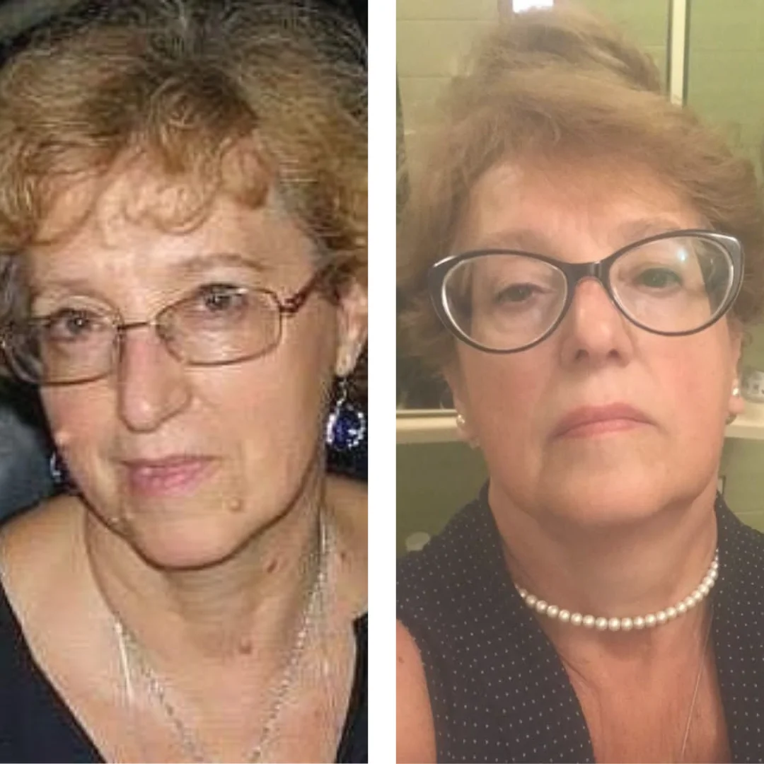 Множественные новообразования на теле